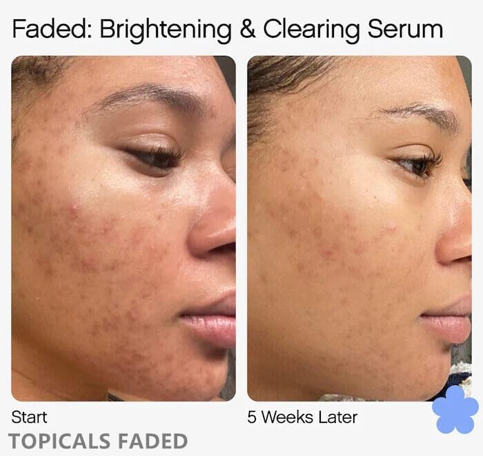 🌟 TOPICALS FADED Serum – Vegan, Gluten-Free, Cruelty-Free – 1.7oz / 50ml (NEW VERSION)